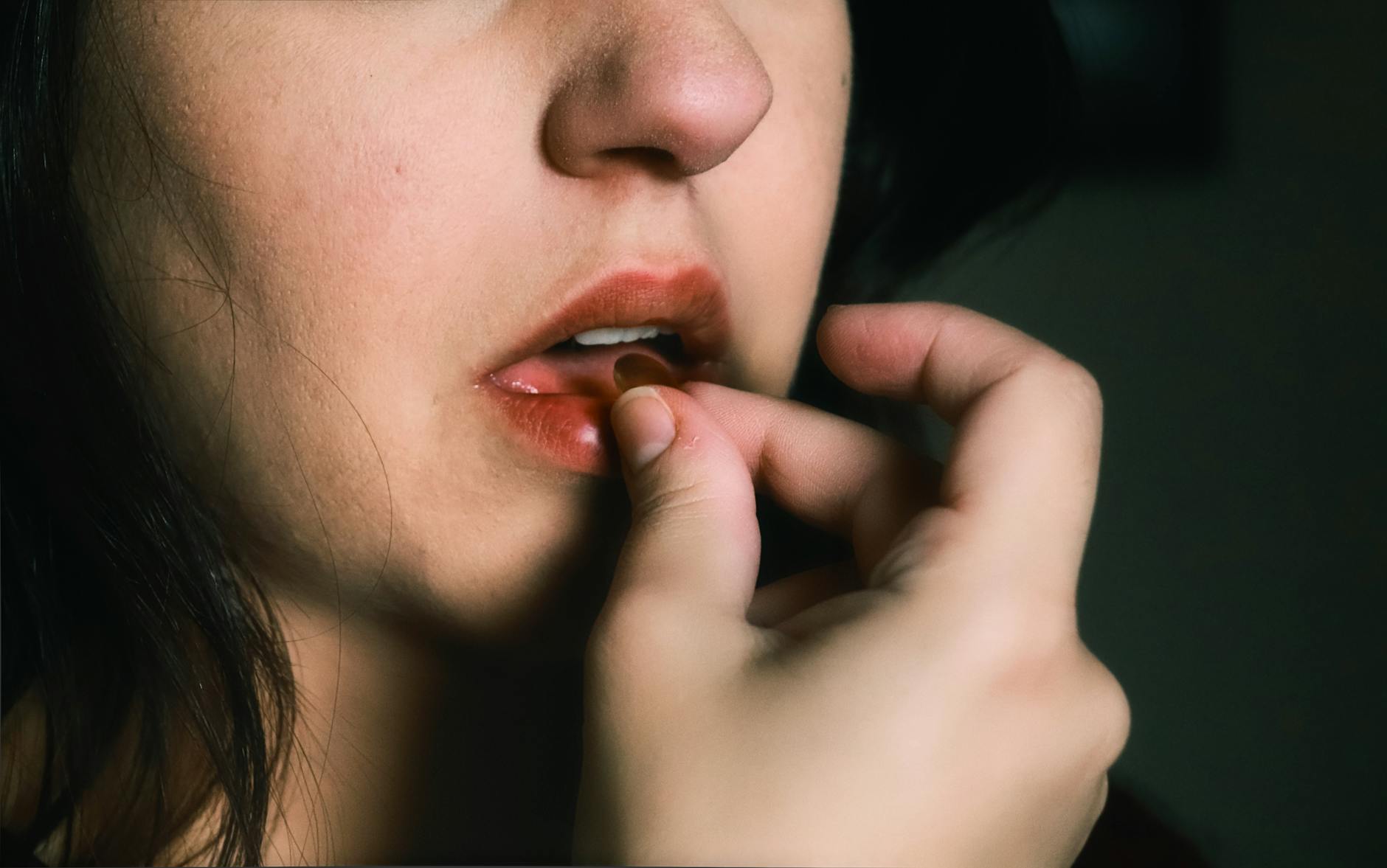 Lip Care Supplements
