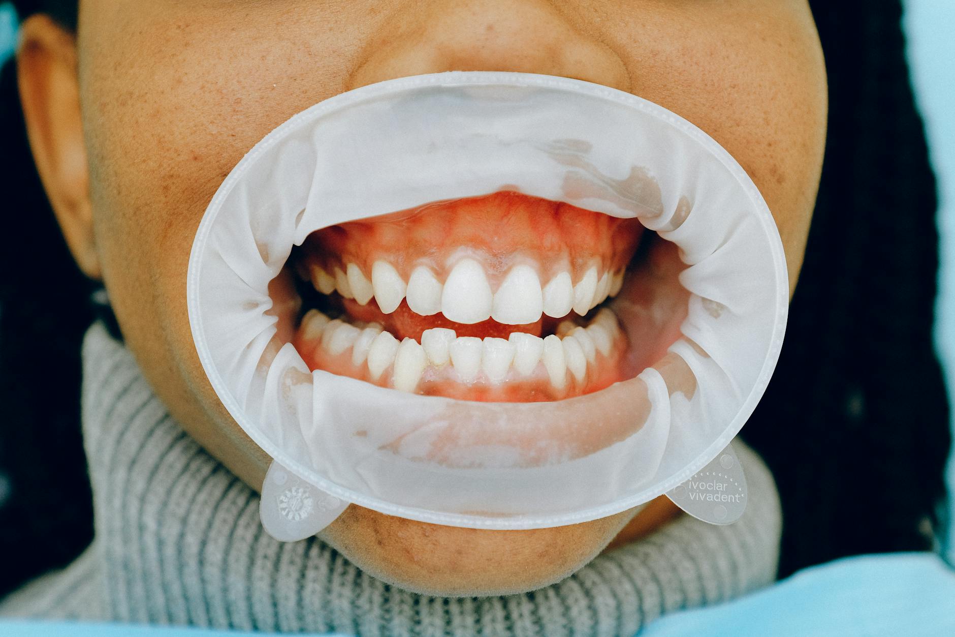 Functional Gum