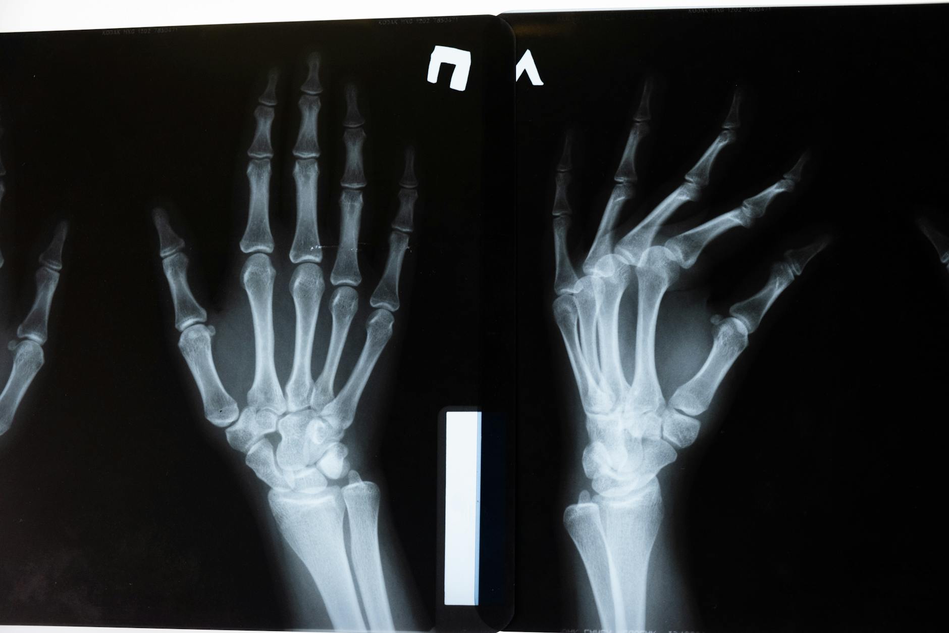 Bone & Joint Health