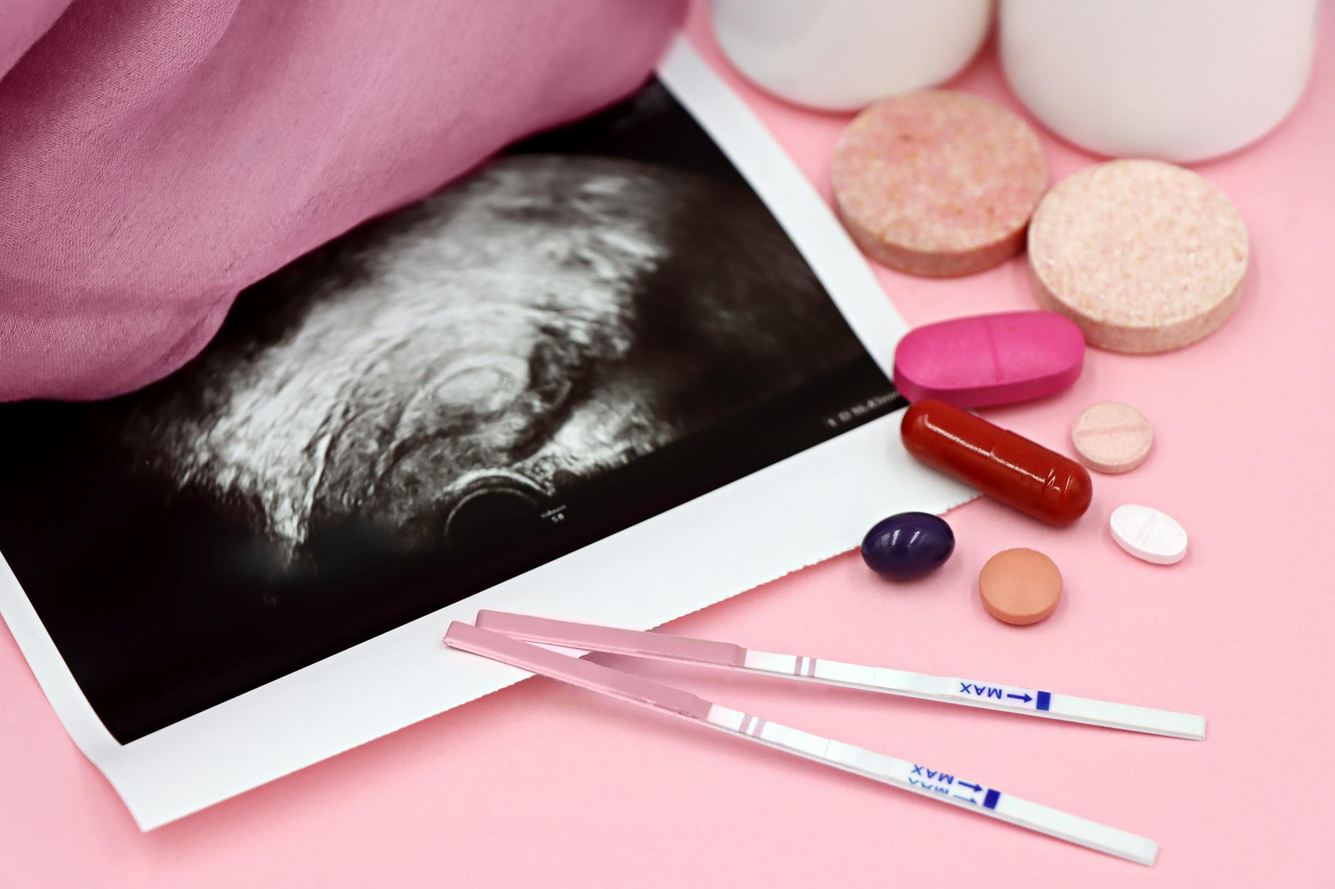 Prenatal